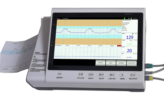 التوائم في المستشفى التحقيق CTG جهاز مراقبة معدل ضربات القلب الجنين مع الطابعة