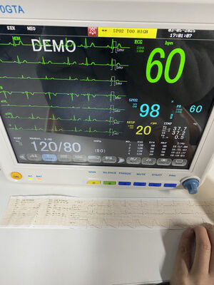 جهاز مراقبة بجانب السرير المحمول مع ECG SPO2 NIBP TEMP RESP اختياري ETCO2-فئة II ضمان لمدة سنة واحدة